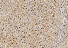 PPP1CB Antibody - 1:100 staining rat liver tissue by IHC-P. The sample was formaldehyde fixed and a heat mediated antigen retrieval step in citrate buffer was performed. The sample was then blocked and incubated with the antibody for 1.5 hours at 22°C. An HRP conjugated goat anti-rabbit antibody was used as the secondary.
