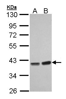 PPP1CC / PP1 Gamma Antibody - Sample (30 ug of whole cell lysate). A: Hep G2 , B: Molt-4 . 10% SDS PAGE. PP1 gamma / PPP1CC antibody diluted at 1:1000