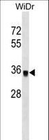 PPP1CC / PP1 Gamma Antibody - PPP1CC Antibody western blot of WiDr cell line lysates (35 ug/lane). The PPP1CC antibody detected the PPP1CC protein (arrow).