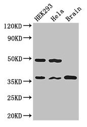 PPP1CC / PP1 Gamma Antibody - Western Blot Positive WB detected in: HEK293 whole cell lysate, Hela whole cell lysate, Mouse brain tissue All lanes: PPP1CC antibody at 2.7µg/ml Secondary Goat polyclonal to rabbit IgG at 1/50000 dilution Predicted band size: 37, 39 kDa Observed band size: 37, 50 kDa