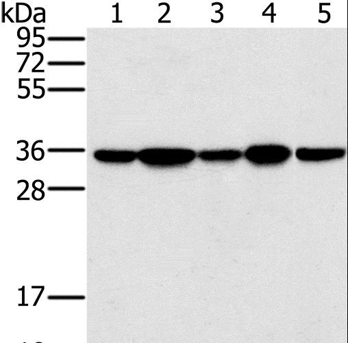 PPP1CC / PP1 Gamma Antibody - Western blot analysis of Jurkat, 293T and HeLa cell, mouse brain tissue and K562 cell, using PPP1CC Polyclonal Antibody at dilution of 1:200.