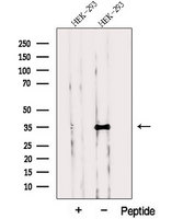 PPP1CC / PP1 Gamma Antibody - Western blot analysis of extracts of HEK293 cells using PPP1CC antibody. The lane on the left was treated with blocking peptide.