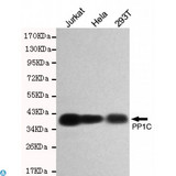 PPP1CC / PP1 Gamma Antibody - Western blot detection of PP1C in Hela, 293T and Jurkat cell lysates using PP1C mouse mAb (1:500 diluted). Predicted band size: 38KDa. Observed band size: 38KDa.