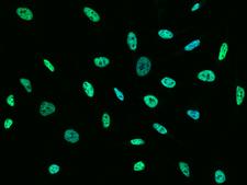 PPP1CC / PP1 Gamma Antibody - Immunofluorescence staining of PPP1CC in HeLa cells. Cells were fixed with 4% PFA, permeabilzed with 0.1% Triton X-100 in PBS, blocked with 10% serum, and incubated with rabbit anti-human PPP1CC polyclonal antibody (dilution ratio 1:1000) at 4°C overnight. Then cells were stained with the Alexa Fluor 488-conjugated Goat Anti-rabbit IgG secondary antibody (green) and counterstained with DAPI (blue). Positive staining was localized to Nucleus.