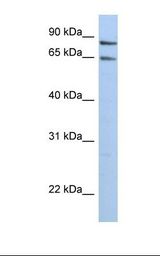 PPP1R10 / PNUTS Antibody - Hela cell lysate. Antibody concentration: 1.0 ug/ml. Gel concentration: 12%.  This image was taken for the unconjugated form of this product. Other forms have not been tested.