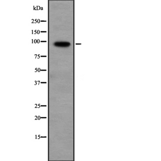 PPP1R10 / PNUTS Antibody - Western blot analysis of PPP1R10 expression in HeLa cells lysate. The lane on the left is treated with the antigen-specific peptide.