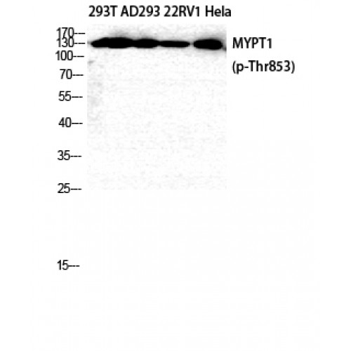 PPP1R12A / MYPT1 Antibody - Western blot of Phospho-MYPT1 (T853) antibody