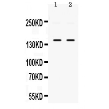 PPP1R12A / MYPT1 Antibody - PPP1R12A antibody Western blot. All lanes: Anti PPP1R12A at 0.5 ug/ml. Lane 1: Mouse Skeletal Muscle Tissue Lysate at 50 ug. Lane 2: HELA Whole Cell Lysate at 40 ug. Predicted band size: 150 kD. Observed band size: 150 kD.