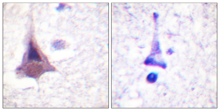 PPP1R12A / MYPT1 Antibody - Immunohistochemistry analysis of paraffin-embedded human brain tissue, using MYPT1 Antibody. The picture on the right is blocked with the synthesized peptide.