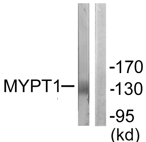 PPP1R12A / MYPT1 Antibody - Western blot analysis of lysates from NIH/3T3 cells, using MYPT1 Antibody. The lane on the right is blocked with the synthesized peptide.