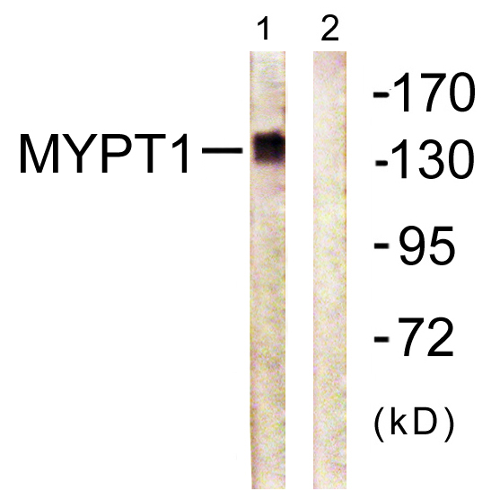 PPP1R12A / MYPT1 Antibody - Western blot analysis of lysates from COS7 cells, using MYPT1 Antibody. The lane on the right is blocked with the synthesized peptide.