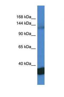 PPP1R12A / MYPT1 Antibody - PPP1R12A / MYPT1 antibody Western blot of Jurkat Cell lysate. Antibody concentration 1 ug/ml.  This image was taken for the unconjugated form of this product. Other forms have not been tested.