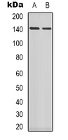 PPP1R12A / MYPT1 Antibody - Western blot analysis of MYPT1 expression in Jurkat (A); SHSY5Y (B); COLO205 (C) whole cell lysates.
