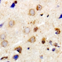PPP1R12A / MYPT1 Antibody - Immunohistochemical analysis of MYPT1 staining in human brain formalin fixed paraffin embedded tissue section. The section was pre-treated using heat mediated antigen retrieval with sodium citrate buffer (pH 6.0). The section was then incubated with the antibody at room temperature and detected using an HRP polymer system. DAB was used as the chromogen. The section was then counterstained with hematoxylin and mounted with DPX.
