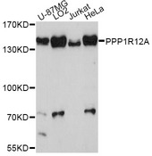 PPP1R12A / MYPT1 Antibody - Western blot analysis of extracts of various cell lines, using PPP1R12A antibody at 1:3000 dilution. The secondary antibody used was an HRP Goat Anti-Rabbit IgG (H+L) at 1:10000 dilution. Lysates were loaded 25ug per lane and 3% nonfat dry milk in TBST was used for blocking. An ECL Kit was used for detection and the exposure time was 90s.