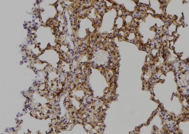 PPP1R12A / MYPT1 Antibody - 1:100 staining mouse lung tissue by IHC-P. The sample was formaldehyde fixed and a heat mediated antigen retrieval step in citrate buffer was performed. The sample was then blocked and incubated with the antibody for 1.5 hours at 22°C. An HRP conjugated goat anti-rabbit antibody was used as the secondary.