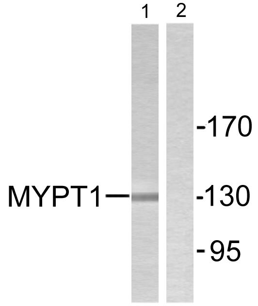 PPP1R12A / MYPT1 Antibody - Western blot analysis of extracts from NIH/3T3 cells, using MYPT1 (Ab-853) antibody.