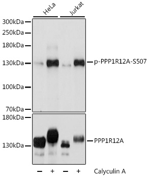 PPP1R12A / MYPT1 Antibody - Western blot analysis of extracts of various cell lines, using Phospho-PPP1R12A-S507 antibody at 1:2000 dilution or PPP1R12A antibody. HeLa cells were treated by Calyculin A (100 nM) at 37â„ƒ for 30 minutes after serum-starvation overnight. Jurkat cells were treated by Calyculin A (100 nM) at 37â„ƒ for 30 minutes. The secondary antibody used was an HRP Goat Anti-Rabbit IgG (H+L) at 1:10000 dilution. Lysates were loaded 25ug per lane and 3% nonfat dry milk in TBST was used for blocking. Blocking buffer: 3% BSA.An ECL Kit was used for detection and the exposure time was 1s.
