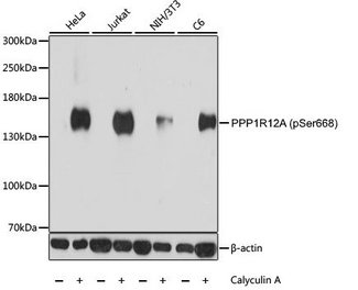 PPP1R12A / MYPT1 Antibody - Western blot analysis of HeLa, Jurkat, NIH/3T3 and C6 cell lysates, untreated or treated with Calyculin A using Rabbit anti PPP1R12A antibody at a 1/1000 dilution. Cells were cultured in serum free media overnight before treatment with Calyculin A for 30 minutes. 3% BSA was used for blocking.