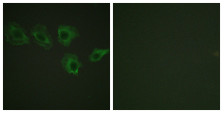 PPP1R12A / MYPT1 Antibody - Immunofluorescence analysis of A549 cells, using MYPT1 (Phospho-Thr696) Antibody. The picture on the right is blocked with the phospho peptide.