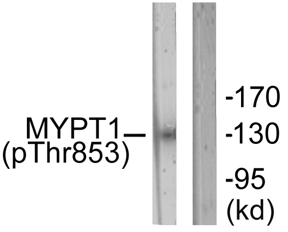 PPP1R12A / MYPT1 Antibody - Western blot analysis of lysates from NIH/3T3 cells, using MYPT1 (Phospho-Thr853) Antibody. The lane on the right is blocked with the phospho peptide.