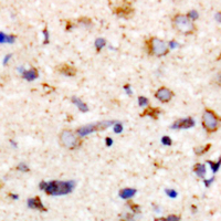 PPP1R12A / MYPT1 Antibody - Immunohistochemical analysis of MYPT1 (pT853) staining in human brain formalin fixed paraffin embedded tissue section. The section was pre-treated using heat mediated antigen retrieval with sodium citrate buffer (pH 6.0). The section was then incubated with the antibody at room temperature and detected using an HRP conjugated compact polymer system. DAB was used as the chromogen. The section was then counterstained with hematoxylin and mounted with DPX.