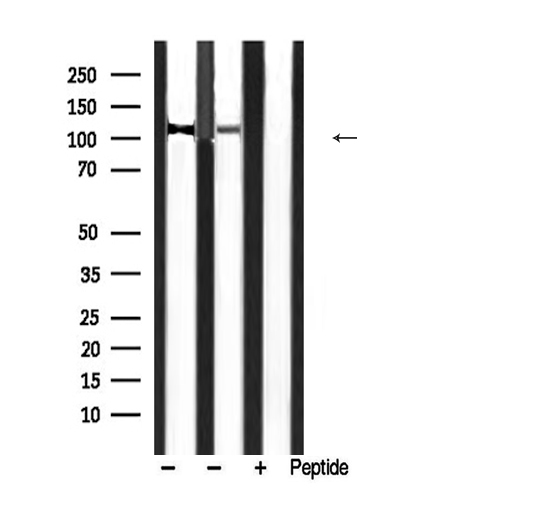 PPP1R12A / MYPT1 Antibody - Western blot analysis of extracts of various smaple using PMYPT1 (Phospho-Thr853) antibody.