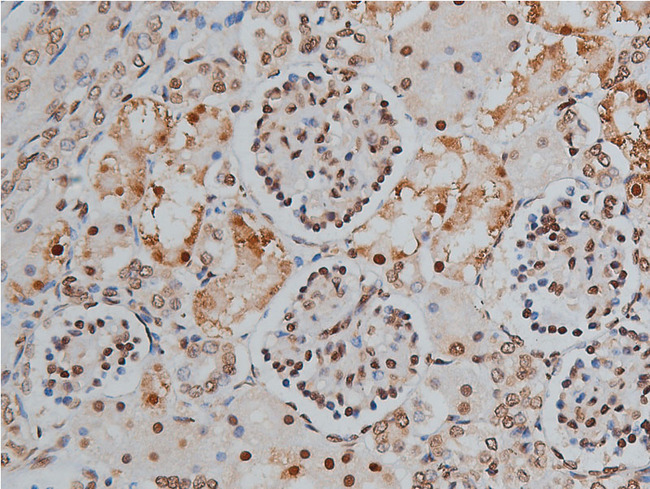 PPP1R12A / MYPT1 Antibody - 1:200 staining human kidney tissue by IHC-P. The tissue was formaldehyde fixed and a heat mediated antigen retrieval step in citrate buffer was performed. The tissue was then blocked and incubated with the antibody for 1.5 hours at 22°C. An HRP conjugated goat anti-rabbit antibody was used as the secondary.