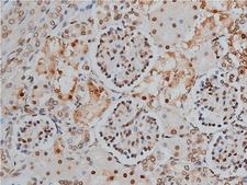PPP1R12A / MYPT1 Antibody - 1:200 staining human kidney tissue by IHC-P. The tissue was formaldehyde fixed and a heat mediated antigen retrieval step in citrate buffer was performed. The tissue was then blocked and incubated with the antibody for 1.5 hours at 22°C. An HRP conjugated goat anti-rabbit antibody was used as the secondary.
