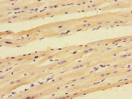PPP1R12C / MBS85 Antibody - Immunohistochemistry of paraffin-embedded human heart tissue using PPP1R12C Antibody at dilution of 1:100
