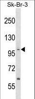 PPP1R13B Antibody - PPP1R13B Antibody western blot of SK-BR-3 cell line lysates (35 ug/lane). The PPP1R13B antibody detected the PPP1R13B protein (arrow).