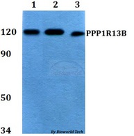 PPP1R13B Antibody - Western blot of PPP1R13B antibody at 1:500 dilution. Lane 1: HEK293T whole cell lysate. Lane 2: Raw264.7 whole cell lysate. Lane 3: H9C2 whole cell lysate.