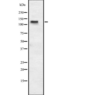 PPP1R13B Antibody - Western blot analysis of ASPP1 expression in HEK293 cells. The lane on the left is treated with the antigen-specific peptide.