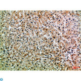 PPP1R13B Antibody - Immunohistochemical analysis of paraffin-embedded Human-liver, antibody was diluted at 1:100.