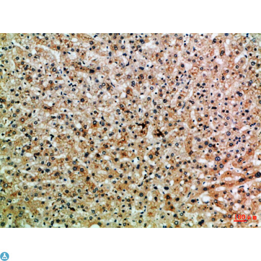 PPP1R13B Antibody - Immunohistochemical analysis of paraffin-embedded Human-liver, antibody was diluted at 1:100.