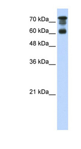 PPP1R13L / iASPP Antibody - PPP1R13L / IASPP antibody Western blot of Transfected 293T cell lysate. This image was taken for the unconjugated form of this product. Other forms have not been tested.