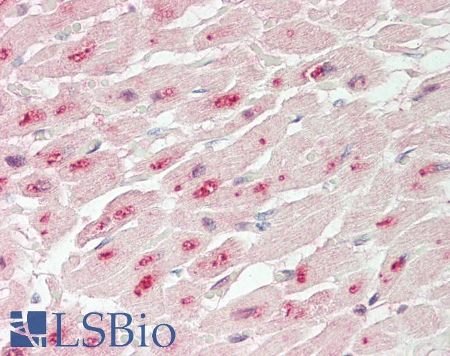 PPP1R13L / iASPP Antibody - Human Heart: Formalin-Fixed, Paraffin-Embedded (FFPE).  This image was taken for the unconjugated form of this product. Other forms have not been tested.
