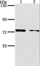 PPP1R13L / iASPP Antibody - Western blot analysis of MCF7 and HeLa cell, using PPP1R13L Polyclonal Antibody at dilution of 1:500.