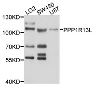 PPP1R13L / iASPP Antibody - Western blot analysis of extracts of various cell lines, using PPP1R13L antibody at 1:1000 dilution. The secondary antibody used was an HRP Goat Anti-Rabbit IgG (H+L) at 1:10000 dilution. Lysates were loaded 25ug per lane and 3% nonfat dry milk in TBST was used for blocking. An ECL Kit was used for detection and the exposure time was 10s.