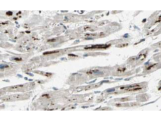 PPP1R13L / iASPP Antibody - Affinity Purified anti-iASPP antibody shows strong cytoplasmic and membranous staining of myocytes in human heart tissue. Tissue was formalin-fixed and paraffin embedded. Brown color indicates presence of protein, blue color shows cell nuclei.