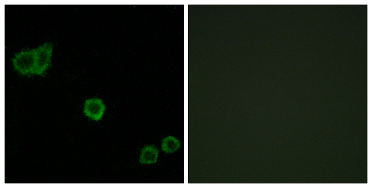 PPP1R14A / CPI-17 Antibody - Immunofluorescence analysis of HeLa cells, using CPI17 alpha Antibody. The picture on the right is blocked with the synthesized peptide.