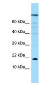 PPP1R14A / CPI-17 Antibody - PPP1R14A / CPI-17 antibody Western Blot of PANC1.  This image was taken for the unconjugated form of this product. Other forms have not been tested.
