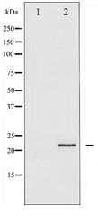PPP1R14A / CPI-17 Antibody - Western blot of CPI17alpha expression in HT29 whole cell lysates,The lane on the left is treated with the antigen-specific peptide.