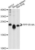 PPP1R14A / CPI-17 Antibody - Western blot analysis of extracts of various cell lines, using PPP1R14A antibody at 1:1000 dilution. The secondary antibody used was an HRP Goat Anti-Rabbit IgG (H+L) at 1:10000 dilution. Lysates were loaded 25ug per lane and 3% nonfat dry milk in TBST was used for blocking. An ECL Kit was used for detection and the exposure time was 60s.