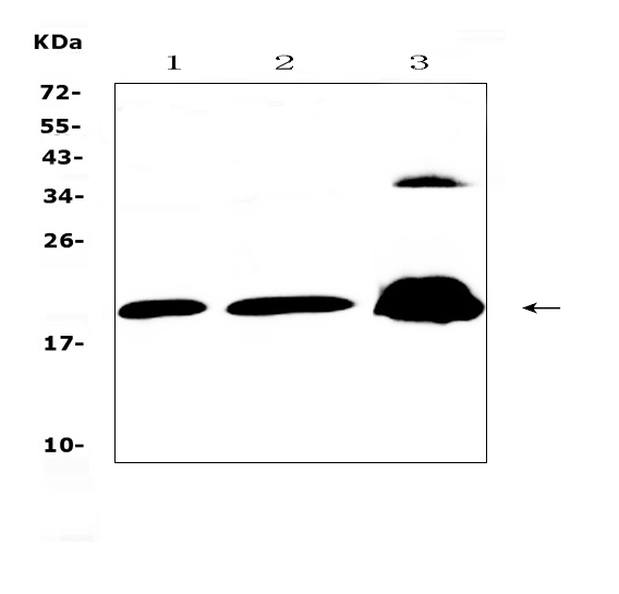 PPP1R14A / CPI-17 Antibody - Western blot analysis of CPI17 alpha using anti-CPI17 alpha antibody. Electrophoresis was performed on a 5-20% SDS-PAGE gel at 70V (Stacking gel) / 90V (Resolving gel) for 2-3 hours. The sample well of each lane was loaded with 50ug of sample under reducing conditions. Lane 1: rat brain tissue lysates, Lane 2: mouse brain tissue lysates, Lane 3: PANC-1 whole Cell lysates. After Electrophoresis, proteins were transferred to a Nitrocellulose membrane at 150mA for 50-90 minutes. Blocked the membrane with 5% Non-fat Milk/ TBS for 1.5 hour at RT. The membrane was incubated with rabbit anti-CPI17 alpha antigen affinity purified polyclonal antibody at 0.5 µg/mL overnight at 4°C, then washed with TBS-0.1% Tween 3 times with 5 minutes each and probed with a goat anti-rabbit IgG-HRP secondary antibody at a dilution of 1:10000 for 1.5 hour at RT. The signal is developed using an Enhanced Chemiluminescent detection (ECL) kit with Tanon 5200 system. A specific band was detected for CPI17 alpha at approximately 20KD. The expected band size for CPI17 alpha is at 20KD.
