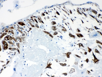 PPP1R14A / CPI-17 Antibody - IHC testing of FFPE human placental tissue with CPI-17 antibody at 1ug/ml. Required HIER: steam section in pH6 citrate buffer for 20 min and allow to cool prior to testing.