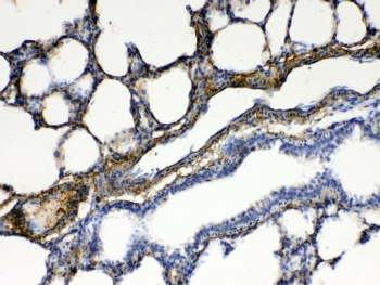 PPP1R14A / CPI-17 Antibody - IHC testing of FFPE rat lung tissue with CPI-17 antibody at 1ug/ml. Required HIER: steam section in pH6 citrate buffer for 20 min and allow to cool prior to testing.
