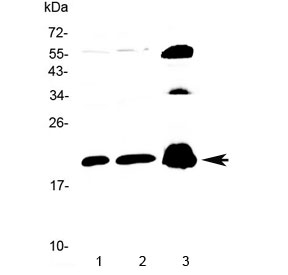 PPP1R14A / CPI-17 Antibody - Western blot testing of 1) rat brain, 2) mouse brain and 3) human PANC1 lysate with CPI-17 antibody at 0.5ug/ml. Predicted molecular weight ~17 kDa.
