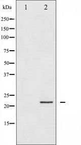 PPP1R14A / CPI-17 Antibody - Western blot analysis of CPI17 alpha expression in HT29 whole cells lysates. The lane on the left is treated with the antigen-specific peptide.