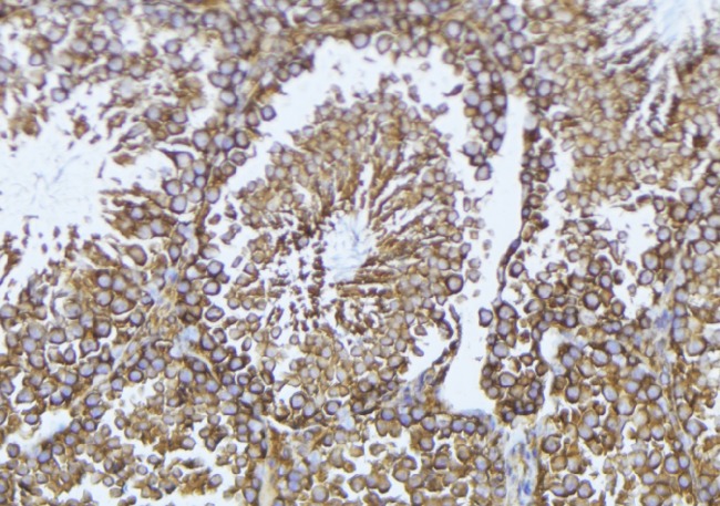 PPP1R14A / CPI-17 Antibody - 1:100 staining mouse testis tissue by IHC-P. The sample was formaldehyde fixed and a heat mediated antigen retrieval step in citrate buffer was performed. The sample was then blocked and incubated with the antibody for 1.5 hours at 22°C. An HRP conjugated goat anti-rabbit antibody was used as the secondary.